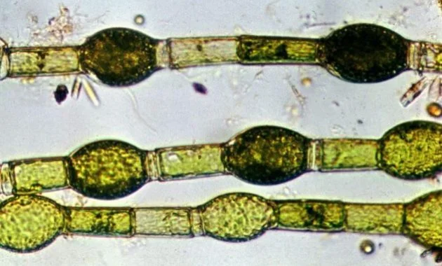 Oedogonium Algae Under Microscope
