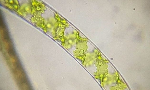 Spirogyra Algae Under Microscope